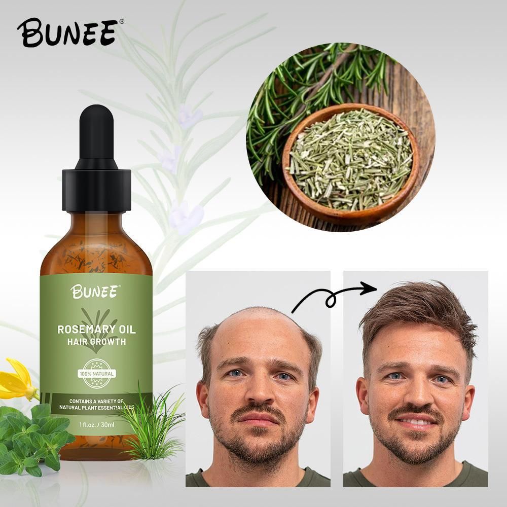 Rosemary Hair Growth Oil (Buy 1 ⚡Get 1 Free⚡)| The Ultimate Hair Elixir