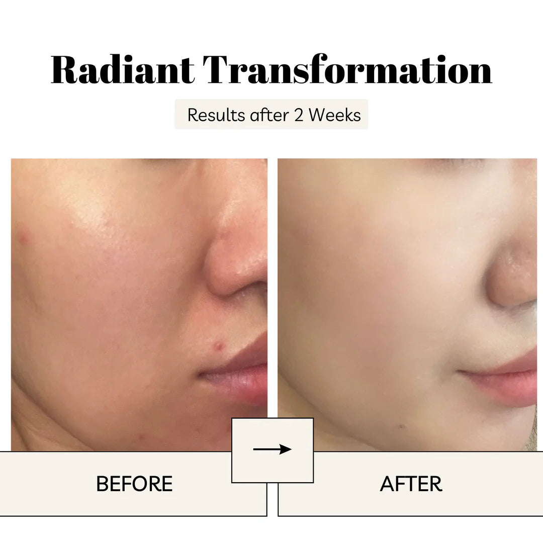 Korean Advanced Snail 96 Mucin Power Essence | Buy 1 Get 1 Free