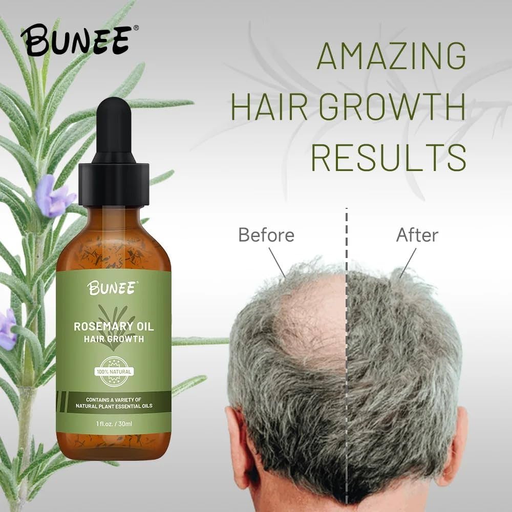 Rosemary Hair Growth Oil (Buy 1 ⚡Get 1 Free⚡)| The Ultimate Hair Elixir