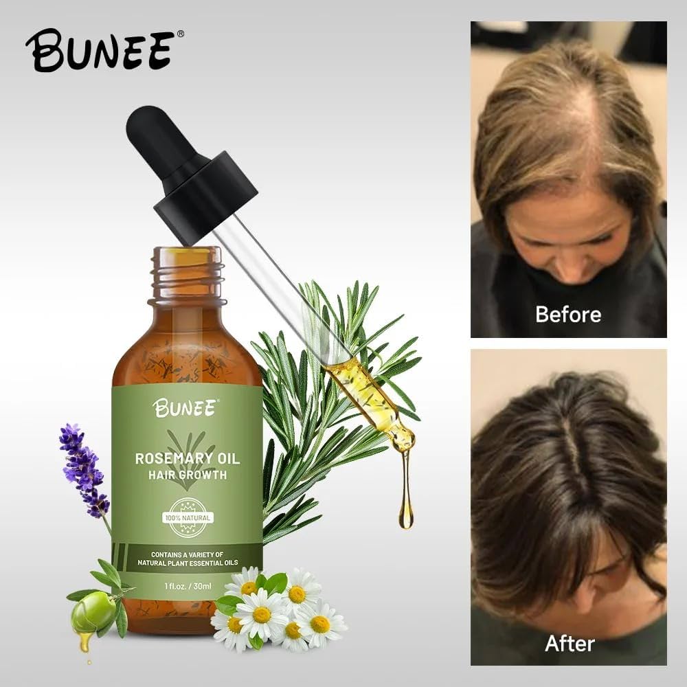 Rosemary Hair Growth Oil (Buy 1 ⚡Get 1 Free⚡)| The Ultimate Hair Elixir
