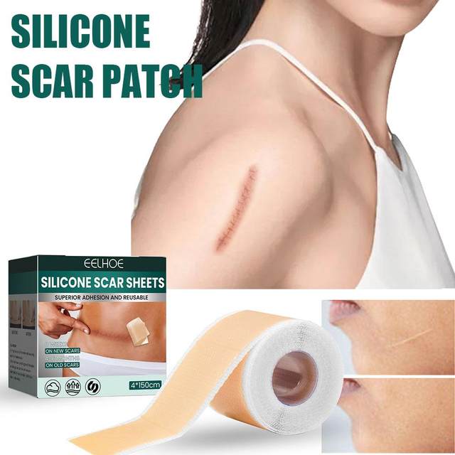 Silicone Scar Sheets for Scars, Acne & Wrinkles – Clinically Proven