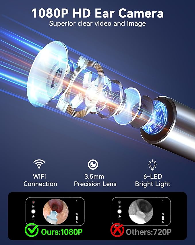 HD Wireless Ear Wax Removal Camera