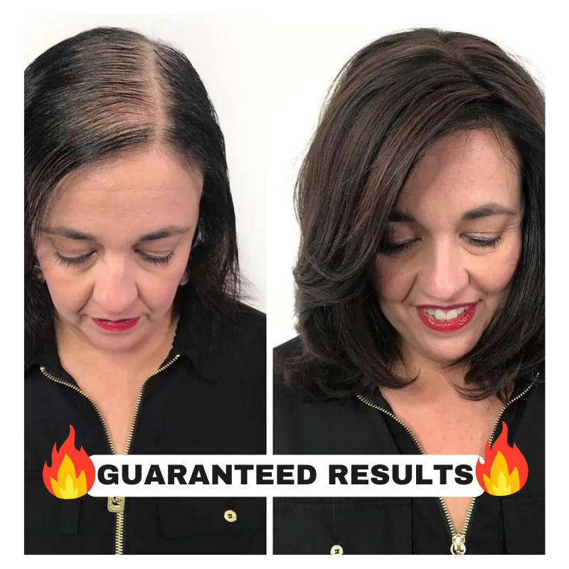 Rosemary Hair Growth Oil (Buy 1 ⚡Get 1 Free⚡)| The Ultimate Hair Elixir