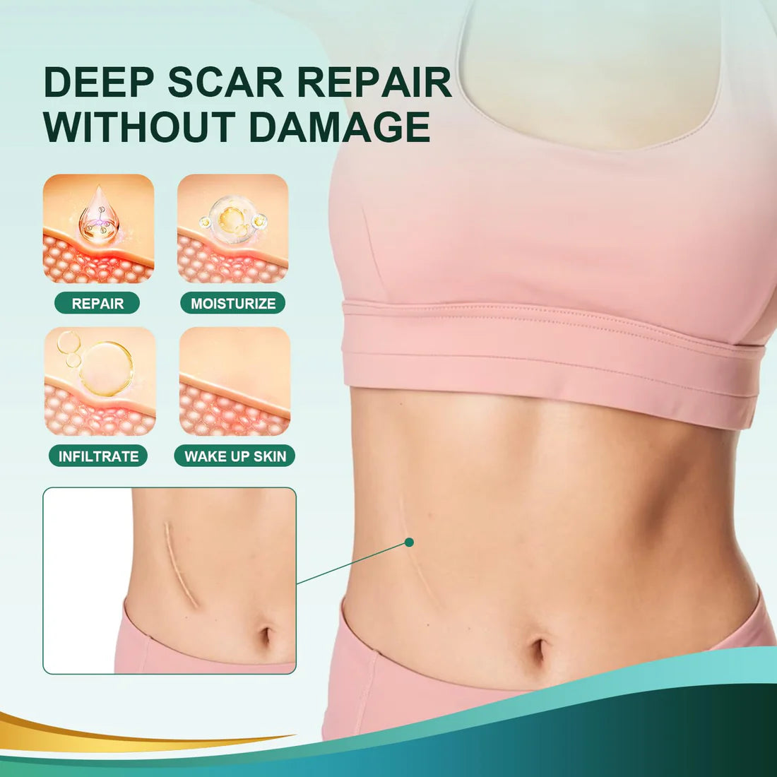 Silicone Scar Sheets for Scars, Acne & Wrinkles – Clinically Proven