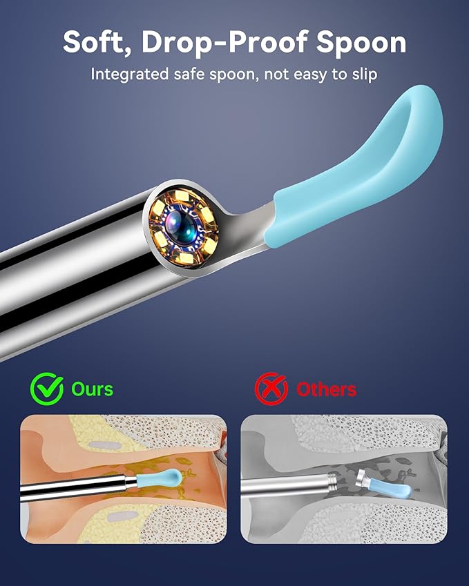 HD Wireless Ear Wax Removal Camera