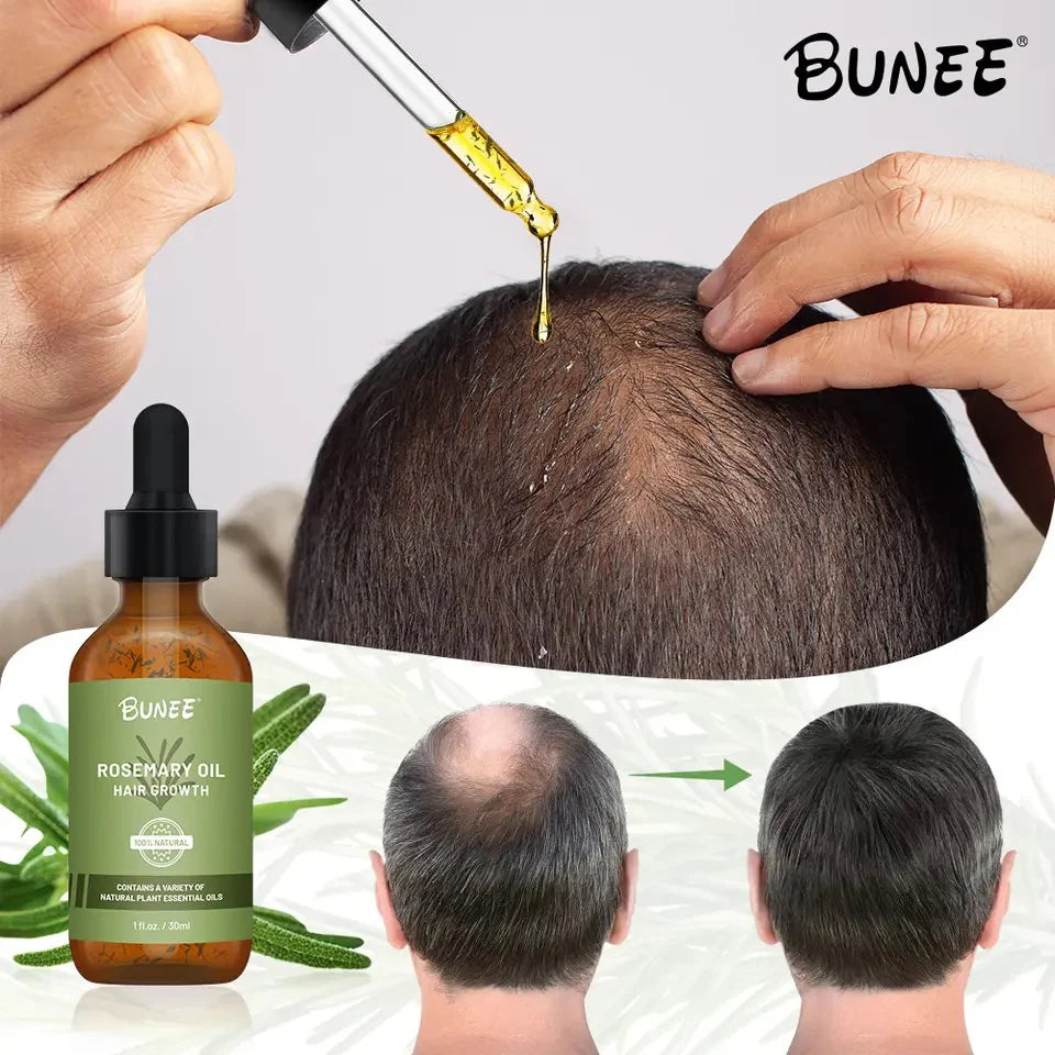 Rosemary Hair Growth Oil (Buy 1 ⚡Get 1 Free⚡)| The Ultimate Hair Elixir